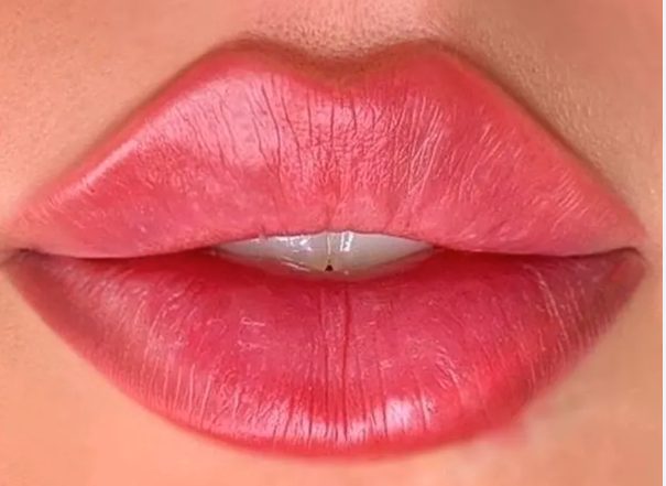 Tehnica Russian Lips Inovație în augmentarea buzelor