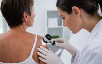 Tumori cutanate: cum le recunoști, când este necesară evaluarea medicală și ce opțiuni de tratament există