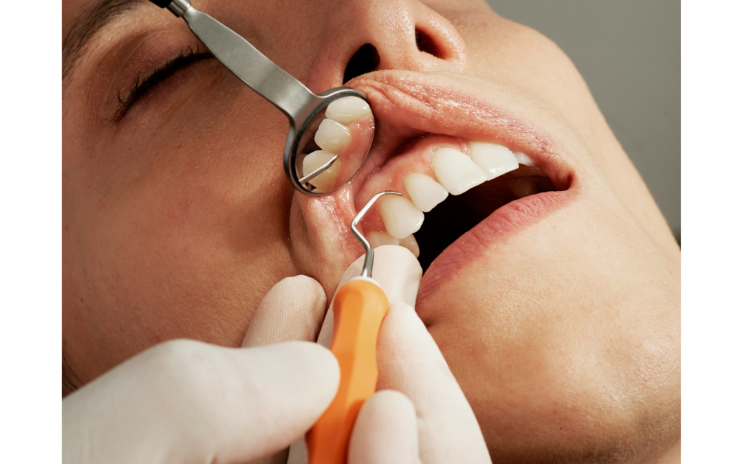 Ce este parodontoza și cum se poate trata?